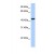 Western Blot: ABHD5 Antibody [NBP1-55457] - This Anti-ABHD5 antibody was used in Western Blot of MCF7 tissue lysate at a concentration of 1ug/ml.